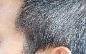 白髪は抜くと増える？