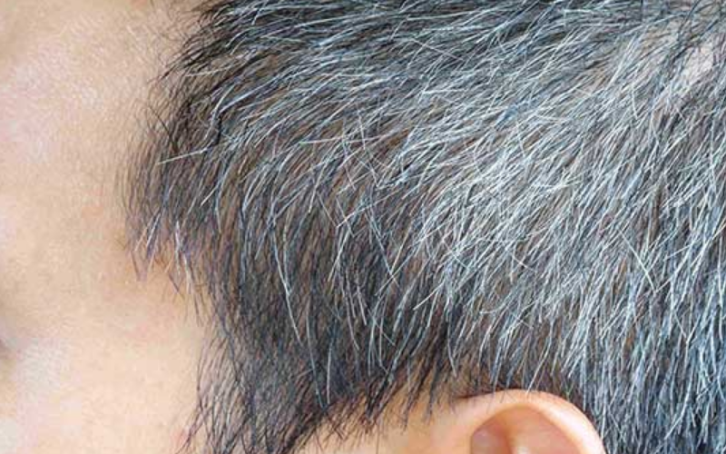白髪は抜くと増える？